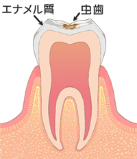 歯科用CT