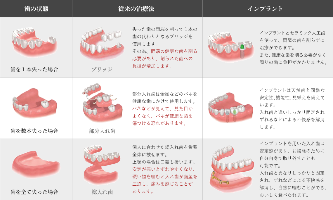 インプラントと従来の治療法の比較